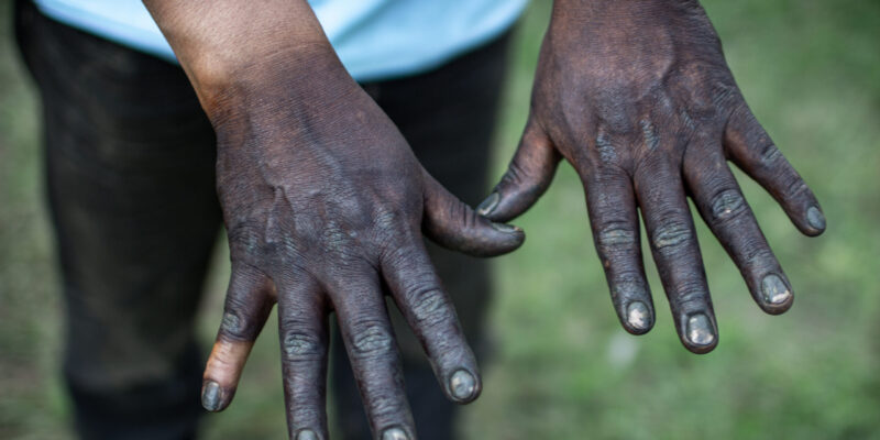 hands 1